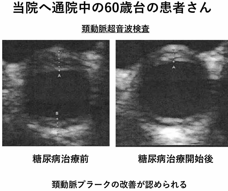 当院へ通院中の60歳台の男性患者様